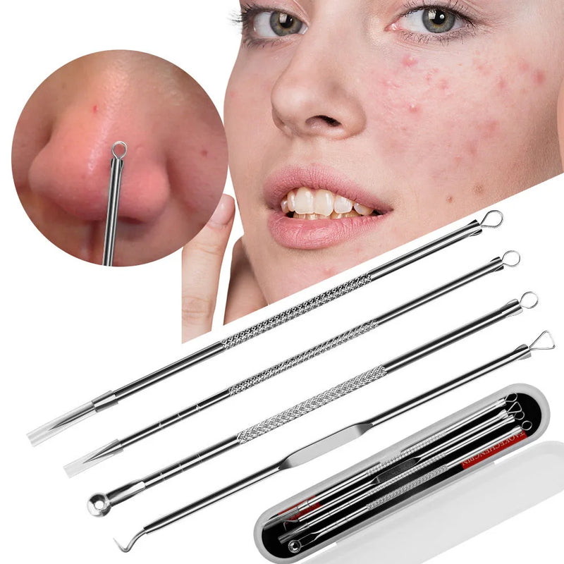 Conjunto REMOVEDOR de acne e cravos